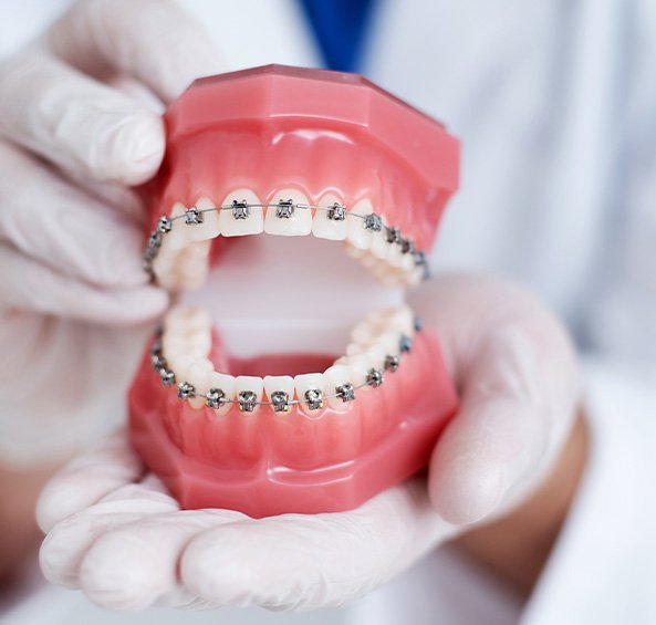 Gloved hands holding model with braces