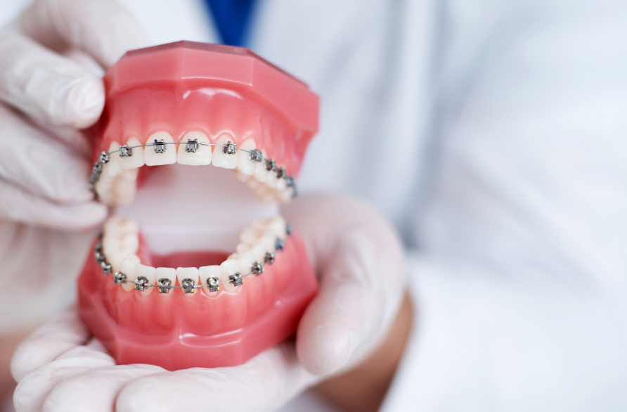 Dentist holding model of teeth with braces